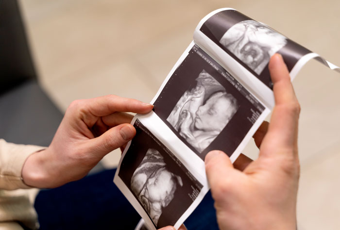 Person holding ultrasound images of an unborn child, examining the photos closely. Person holding ultrasound images of an unborn child, examining the photos closely.