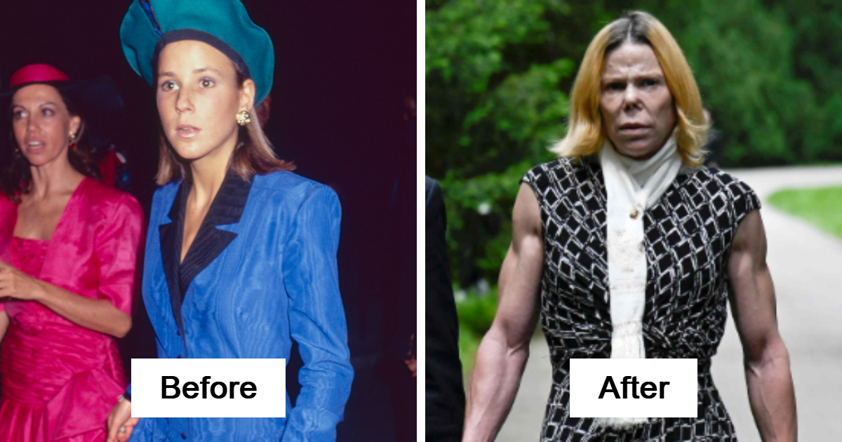 20 Stars Whose Dramatic Transformations Had Everyone Talking This Year
