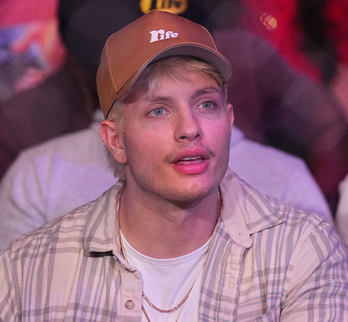 Matt Rife in a plaid shirt and cap reacting to plastic surgery rumors, with a surprised expression. Matt Rife in a plaid shirt and cap reacting to plastic surgery rumors, with a surprised expression.