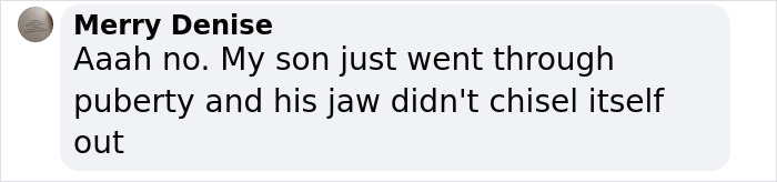 Text comment reacting to plastic surgery rumors about Matt Rife's look. Text comment reacting to plastic surgery rumors about Matt Rife's look.