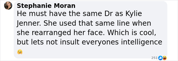 Comment discussing Matt Rife and plastic surgery rumors in a playful tone. Comment discussing Matt Rife and plastic surgery rumors in a playful tone.
