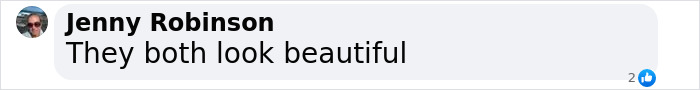 Comment by user Jenny Robinson saying, "They both look beautiful," discussing twins aging naturally and with Botox. Comment by user Jenny Robinson saying, "They both look beautiful," discussing twins aging naturally and with Botox.