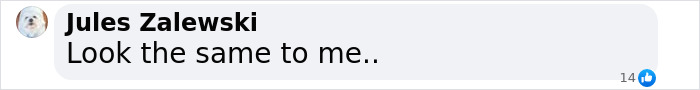 Comment comparing twins, one aging naturally, the other using Botox. Comment comparing twins, one aging naturally, the other using Botox.