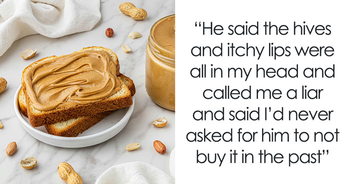 Man Tries To Prove To Wife She Doesn’t Have A Peanut Allergy, Insists On Eating It In Front Of Her