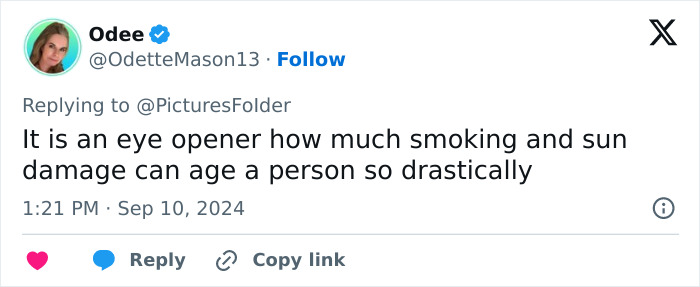 Tweet about eye-opening effects of smoking and sun damage on aging. Tweet about eye-opening effects of smoking and sun damage on aging.