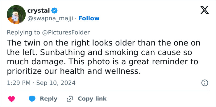 Tweet discussing twins study on divorce and bad diet's impact on facial aging and health priorities. Tweet discussing twins study on divorce and bad diet's impact on facial aging and health priorities.