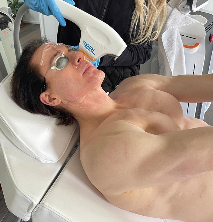 Individual receiving anti-aging treatment using laser therapy, lying calmly on a clinic chair. Individual receiving anti-aging treatment using laser therapy, lying calmly on a clinic chair.