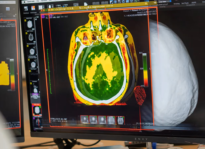 Medical imaging on monitor illustrating body freezing technique for future revival. Medical imaging on monitor illustrating body freezing technique for future revival.