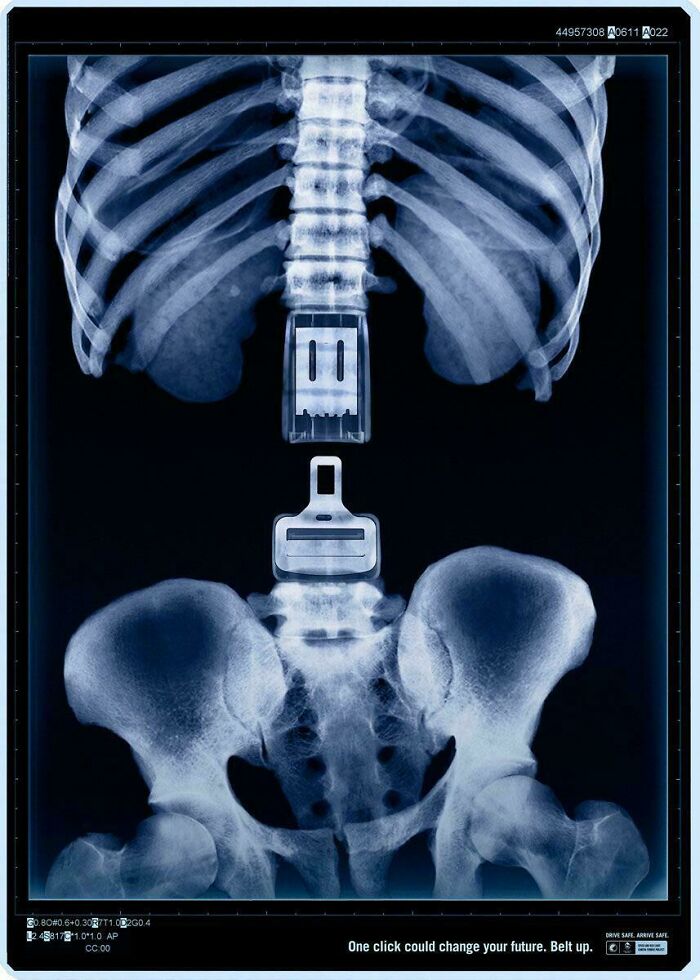X-ray showing seatbelt buckle integrated into spine, a clever design making the world smarter and cooler.