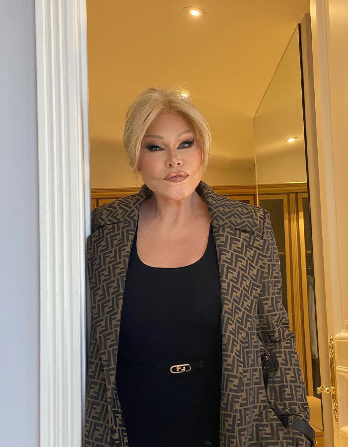 'Catwoman' Jocelyn Wildenstein, Notorious For Extreme Plastic Surgeries, Passes Away At 84 'Catwoman' Jocelyn Wildenstein, Notorious For Extreme Plastic Surgeries, Passes Away At 84