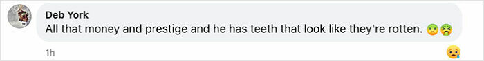 Netizen comments on the shortage of dentists in the UK, referencing a portrait with a critique of teeth appearance. Netizen comments on the shortage of dentists in the UK, referencing a portrait with a critique of teeth appearance.