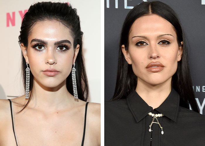 Two women side by side, showcasing effects of plastic surgery, highlighting dramatic transformations. Two women side by side, showcasing effects of plastic surgery, highlighting dramatic transformations.