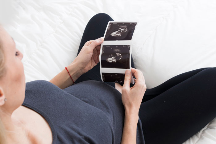 Woman holding ultrasound photos, reflecting on bereavement and miscarriage. Woman holding ultrasound photos, reflecting on bereavement and miscarriage.