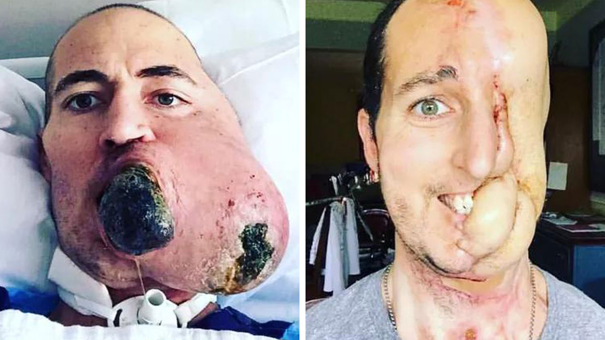 50 Interesting Medical Cases That Might Make You Appreciate The Human Body (New Pics)