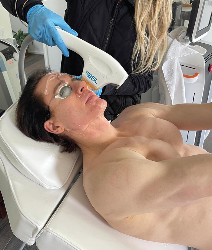 Bryan Johnson undergoing a facial treatment with longevity equipment, wearing protective eyewear. Bryan Johnson undergoing a facial treatment with longevity equipment, wearing protective eyewear.