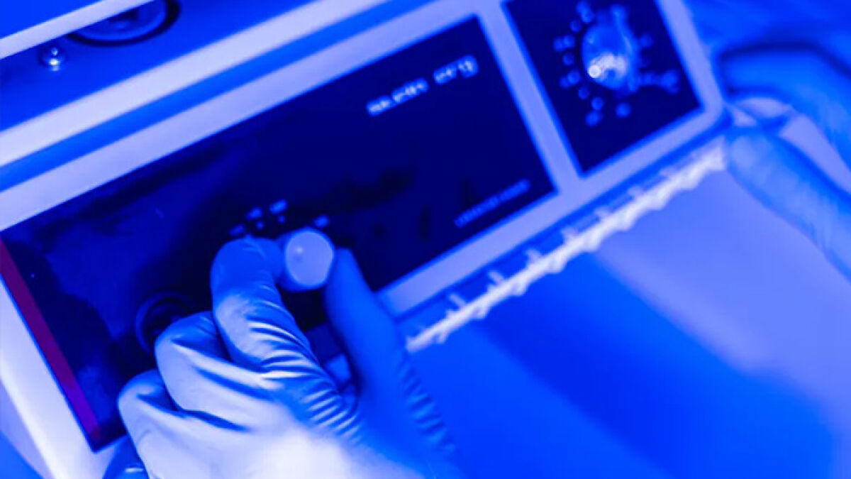 “Hope They Have Backup Power”: People Doubtful Of $200k Life Extension Service