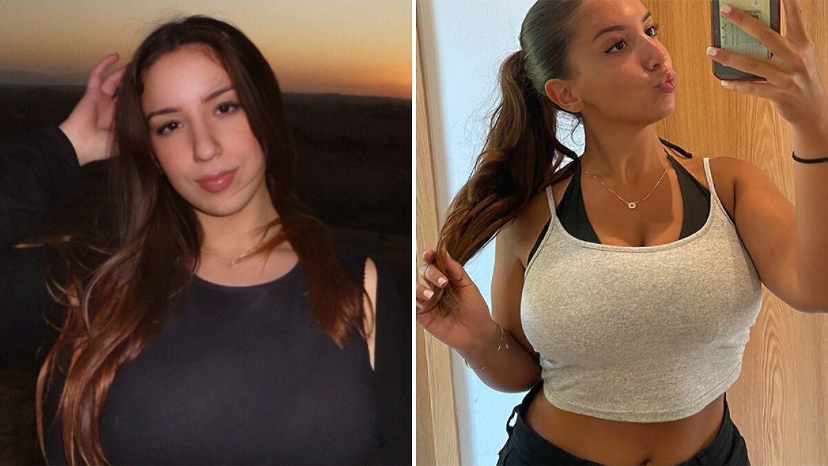 “Always In Pain”: Woman’s 30J Breast Reduction Plea Rejected, Faces Harassment