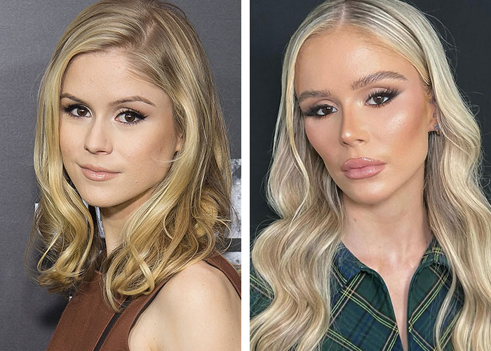 Two side-by-side images of a celebrity before and after plastic surgery, showing significant changes in appearance. Two side-by-side images of a celebrity before and after plastic surgery, showing significant changes in appearance.