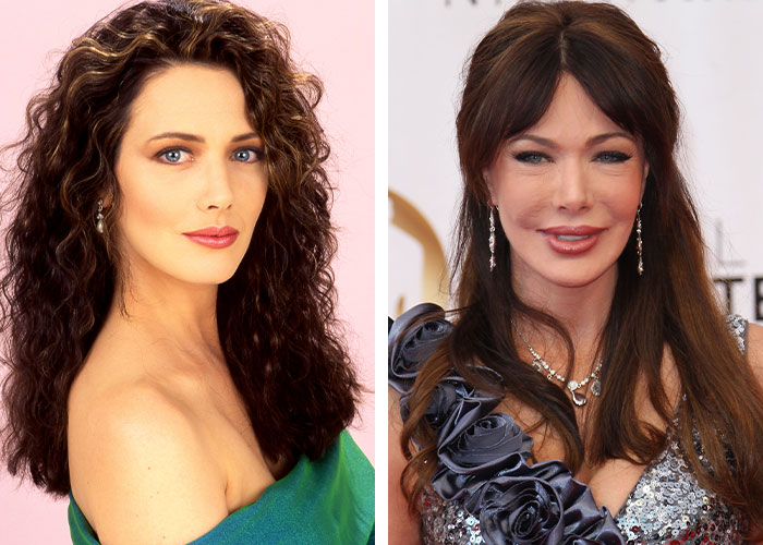 Celebrity before and after plastic surgery, highlighting unrecognizable transformation. Celebrity before and after plastic surgery, highlighting unrecognizable transformation.