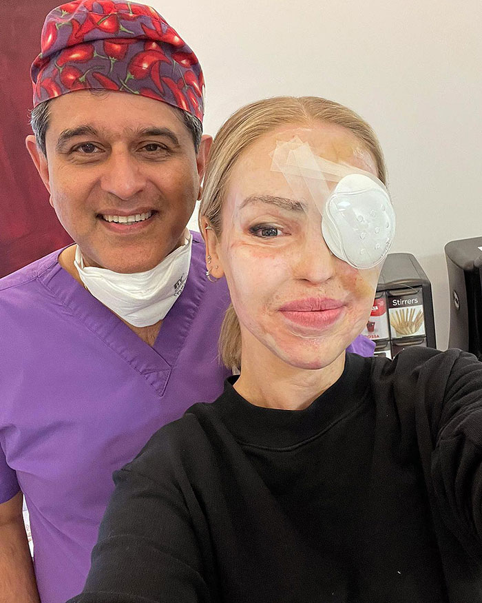 A woman with an eye patch smiles beside a doctor in purple scrubs, sharing health update on eye recovery. A woman with an eye patch smiles beside a doctor in purple scrubs, sharing health update on eye recovery.