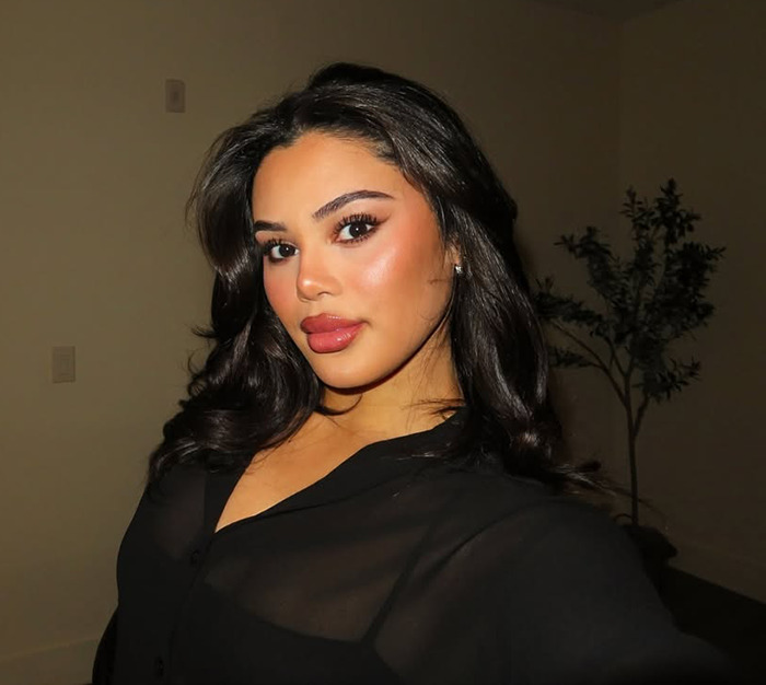 Kaya Odom posing indoors, showcasing her appearance after an Ozempic face treatment. Kaya Odom posing indoors, showcasing her appearance after an Ozempic face treatment.