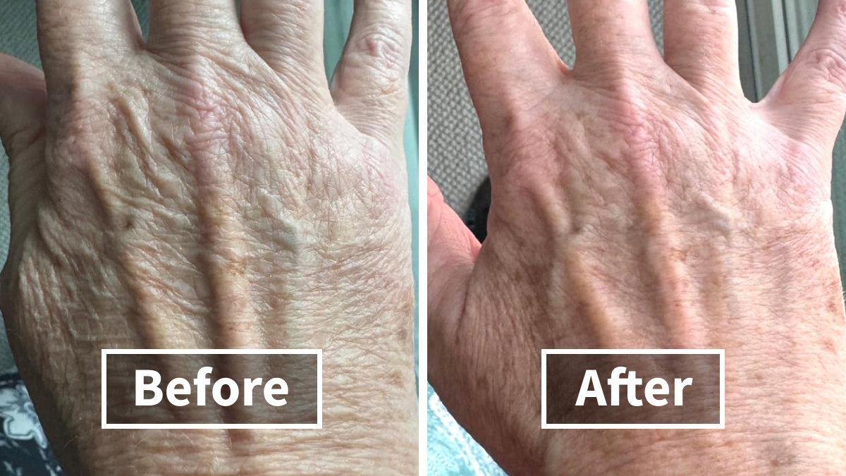 19 Beauty Solutions For Those Winter Issues Nobody Wants To Talk About