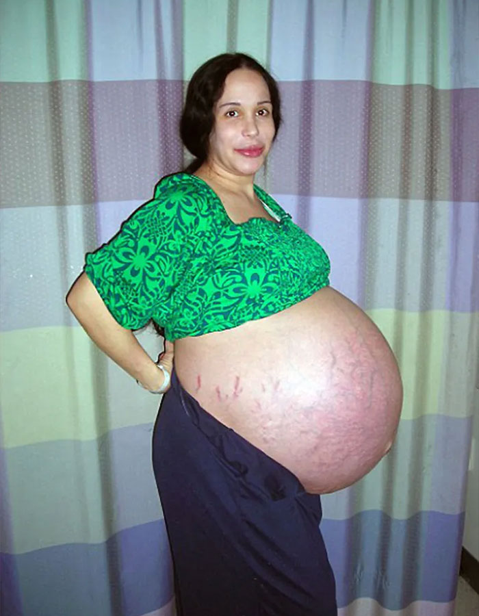 Octomom Nadya Suleman, pregnant with octuplets in 2009, wearing a green shirt and standing sideways against a curtain background. Octomom Nadya Suleman, pregnant with octuplets in 2009, wearing a green shirt and standing sideways against a curtain background.