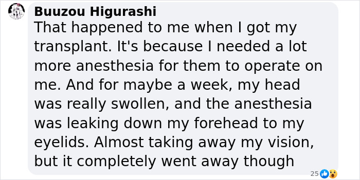 Man shares hair transplant experience results, mentioning head swelling and anesthesia effects. Man shares hair transplant experience results, mentioning head swelling and anesthesia effects.