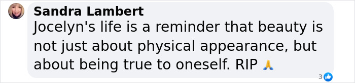 'Catwoman' Jocelyn Wildenstein, Notorious For Extreme Plastic Surgeries, Passes Away At 84 'Catwoman' Jocelyn Wildenstein, Notorious For Extreme Plastic Surgeries, Passes Away At 84