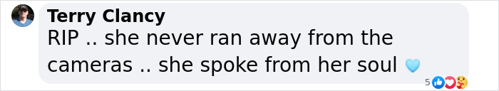 'Catwoman' Jocelyn Wildenstein, Notorious For Extreme Plastic Surgeries, Passes Away At 84 'Catwoman' Jocelyn Wildenstein, Notorious For Extreme Plastic Surgeries, Passes Away At 84