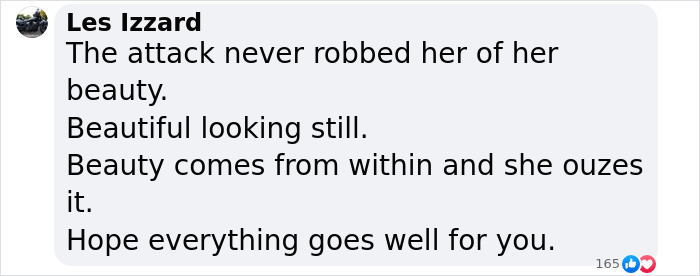 Comment praising beauty and inner strength in light of Katie Piper's eye attack, wishing her well. Comment praising beauty and inner strength in light of Katie Piper's eye attack, wishing her well.