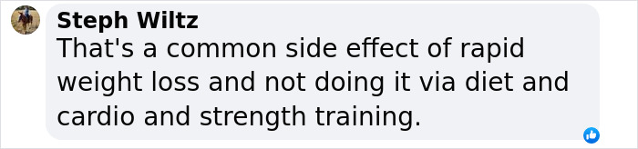 Text from a user discussing "Ozempic butt" as a side effect of rapid weight loss without diet and exercise. Text from a user discussing "Ozempic butt" as a side effect of rapid weight loss without diet and exercise.