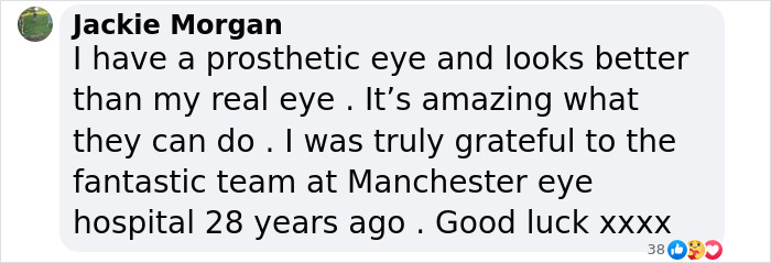 Comment expressing gratitude for eye hospital support related to prosthetic eye improvement. Comment expressing gratitude for eye hospital support related to prosthetic eye improvement.