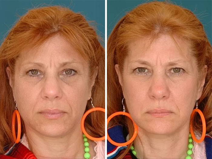 Twin sisters showing the impact of divorce and bad diet on the face, side by side with distinct expressions. Twin sisters showing the impact of divorce and bad diet on the face, side by side with distinct expressions.