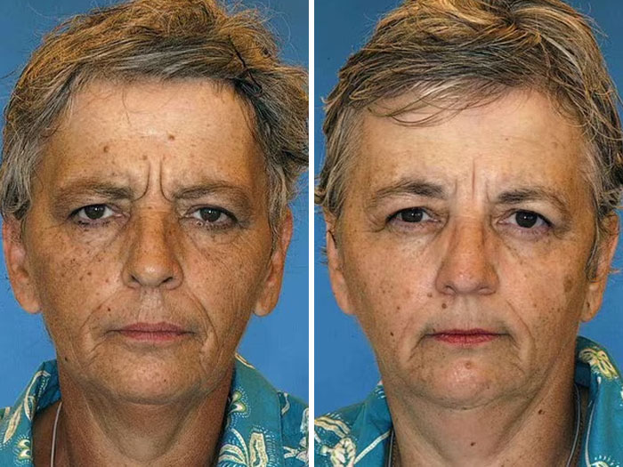 Twins showing impact of divorce and bad diet on facial features in viral study. Twins showing impact of divorce and bad diet on facial features in viral study.