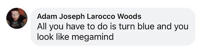 Comment referencing a hair transplant, comparing the results to the character 'Megamind'. Comment referencing a hair transplant, comparing the results to the character 'Megamind'.