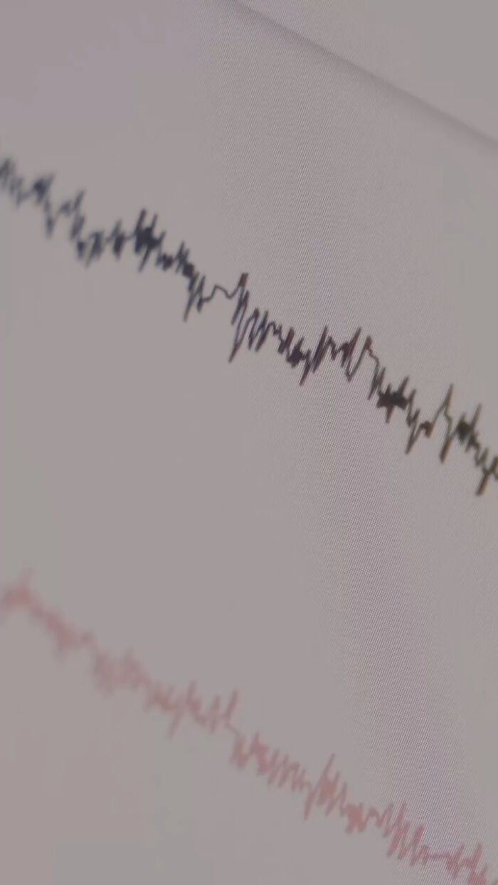 Close-up of unique brain activity imprint tattoo design. Close-up of unique brain activity imprint tattoo design.