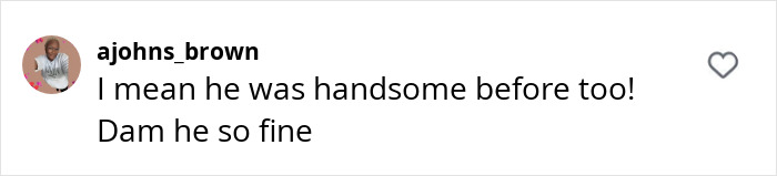 "Comment praises man's plastic surgery transformation, describing him as very handsome. "Comment praises man's plastic surgery transformation, describing him as very handsome.