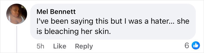 Comment discussing Beyoncé's lighter skin tone, suggesting skin bleaching. Comment discussing Beyoncé's lighter skin tone, suggesting skin bleaching.