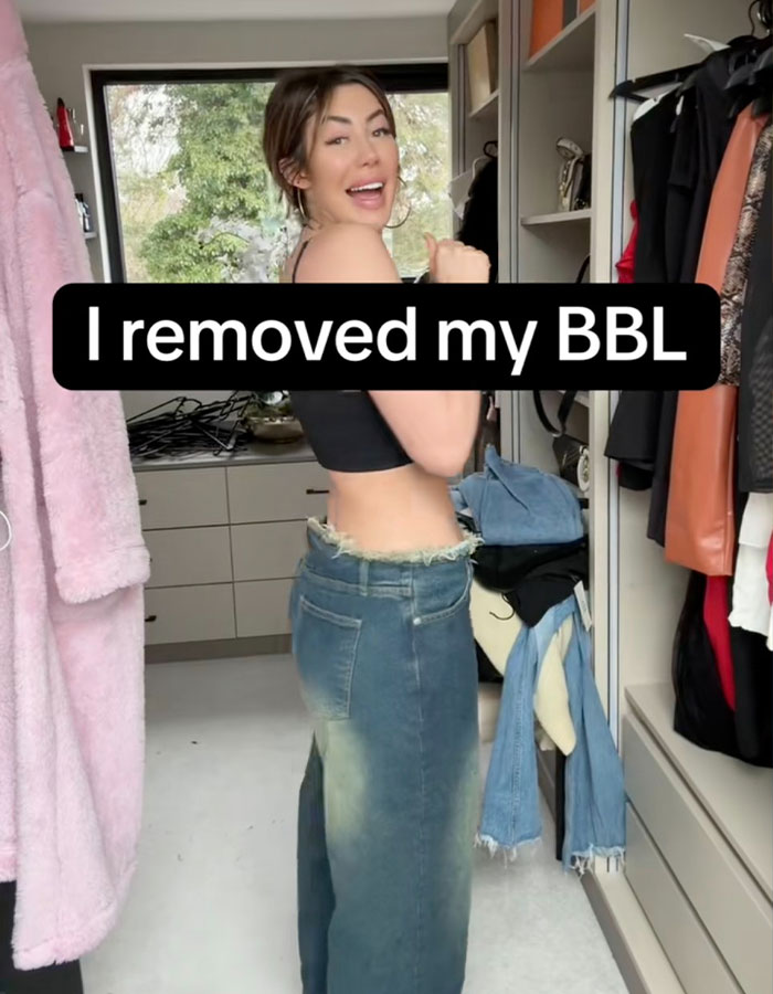 Woman showing new figure after BBL removal, smiling in a closet with jeans and a black top. Woman showing new figure after BBL removal, smiling in a closet with jeans and a black top.