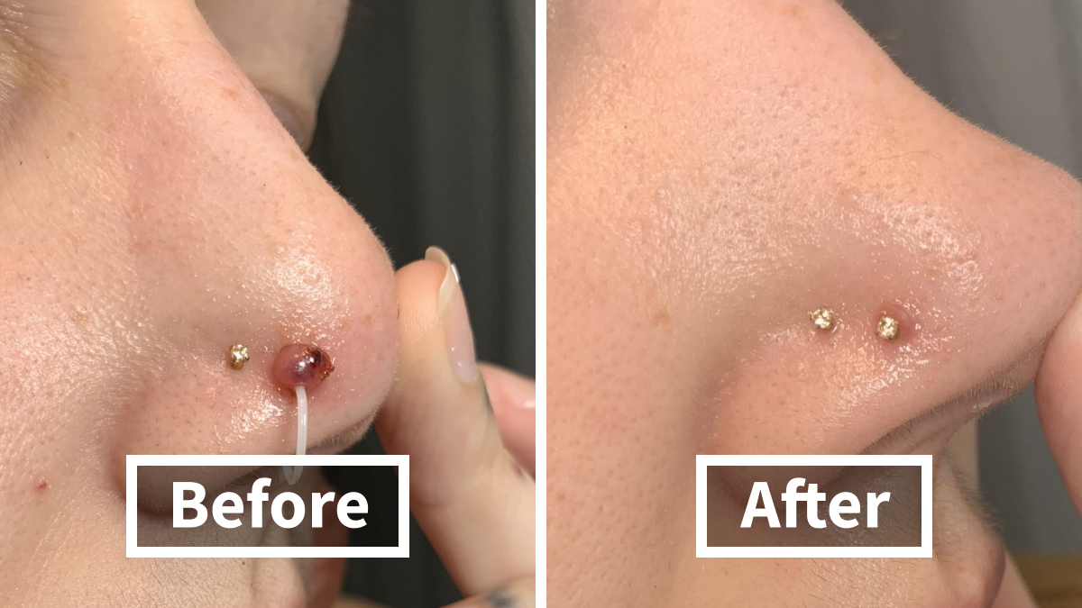 These 24 Before/Afters Are Making Us Poor And We’re Not Mad