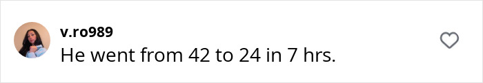 "Comment reads: He went from 42 to 24 in 7 hrs, highlighting plastic surgery transformation. "Comment reads: He went from 42 to 24 in 7 hrs, highlighting plastic surgery transformation.