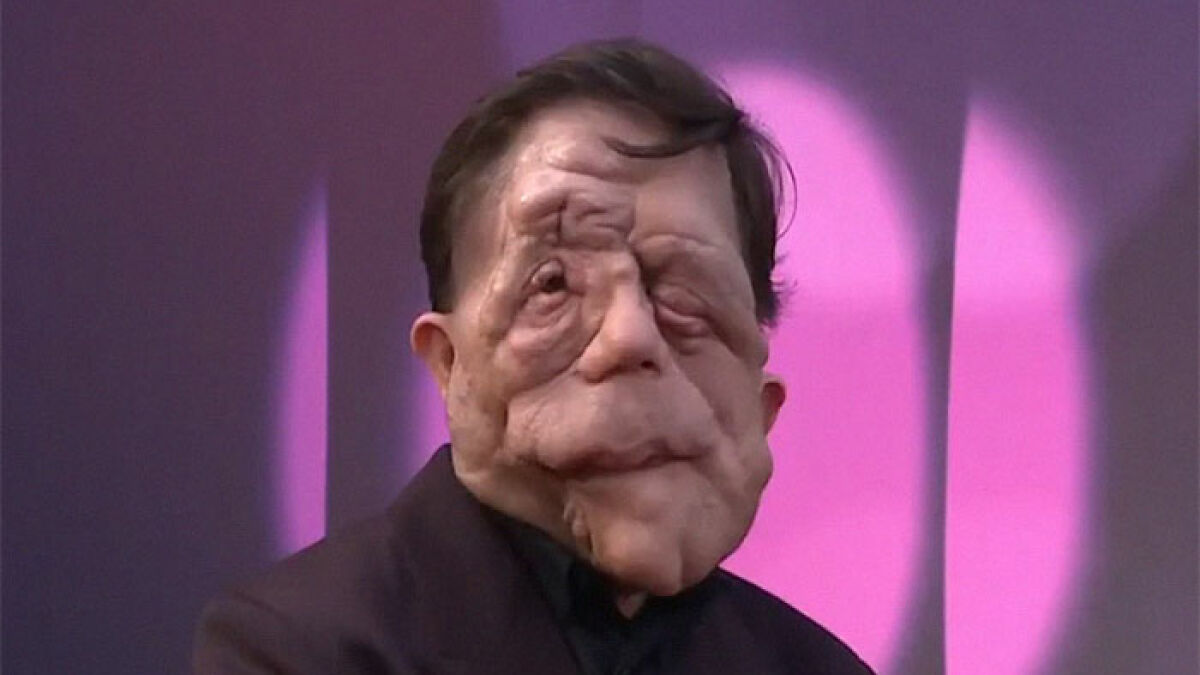 “This Is Called Accountability”: Adam Pearson Refuses To Back Down To Troll Amid “Anti-Trans” Claim