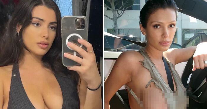 After Suggestion Of “Designer Genitals,” Doctor Reveals The Surgeries Bianca Censori May Have Had