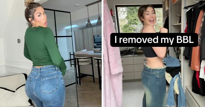 Woman Flaunts New Figure After Getting BBL Removed, Hitting ‘Rock Bottom’ Over Botched Surgeries