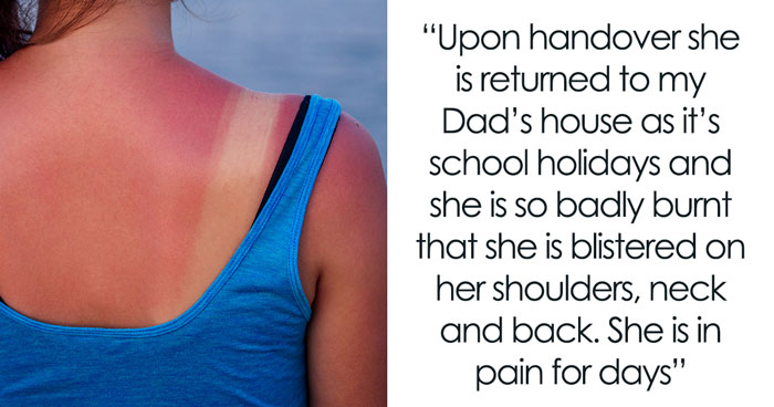 Dad Furious As Ex Lets Their Child Get Sunburned Over Her Partner’s Bizarre Sunscreen Conspiracy