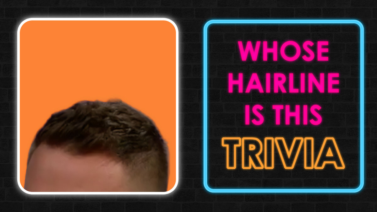 “Before And After Turkey”: 21 Upgraded Hairlines And You Need To Guess Who They Belong To