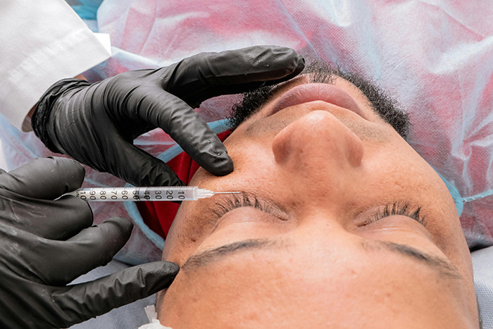 Man undergoing plastic surgery procedure, lying on a table, with a syringe near his eye. Man undergoing plastic surgery procedure, lying on a table, with a syringe near his eye.