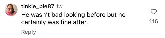 Comment praising man's plastic surgery transformation results, noting a positive change in appearance. Comment praising man's plastic surgery transformation results, noting a positive change in appearance.