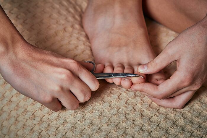 Trimming toenails can prevent stinky feet, demonstrating essential common hygiene habits.